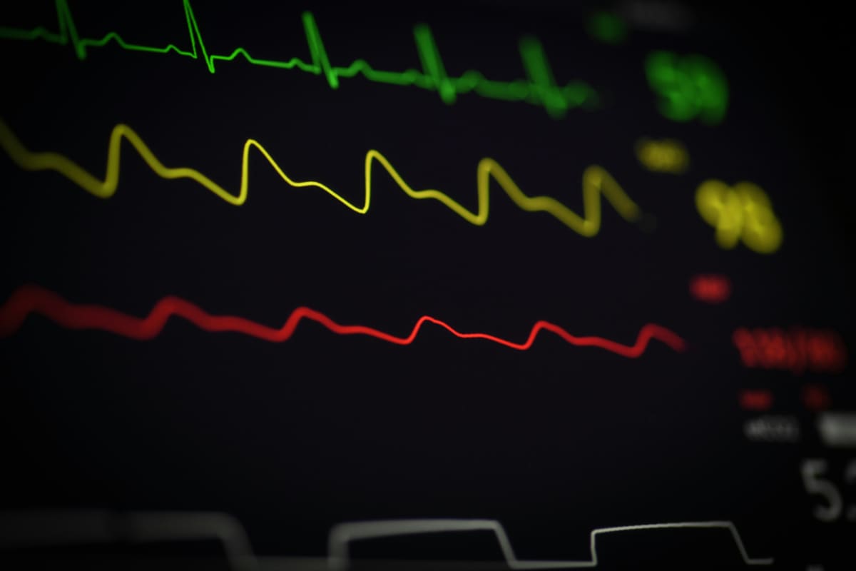 Cómo mejorar tu VO2max: guía práctica